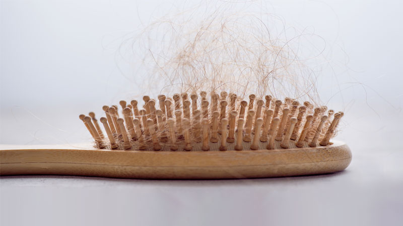 https://www.nm.org/healthbeat/healthy-tips/causes-for-hair-loss