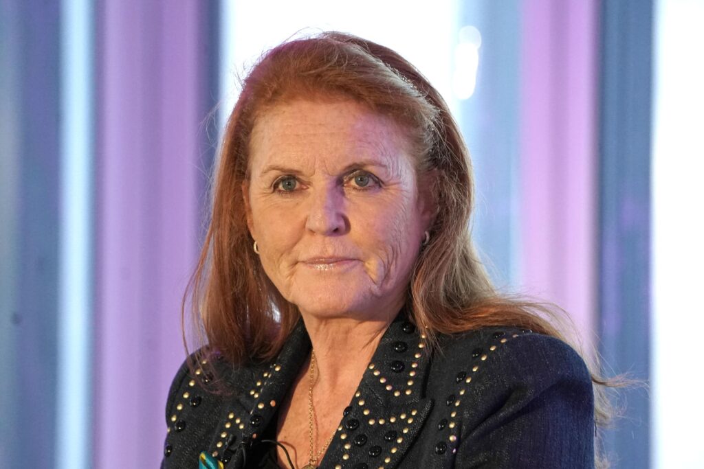 Sarah Ferguson et le mélanome, pourquoi les personnes aux cheveux roux sont plus à risque