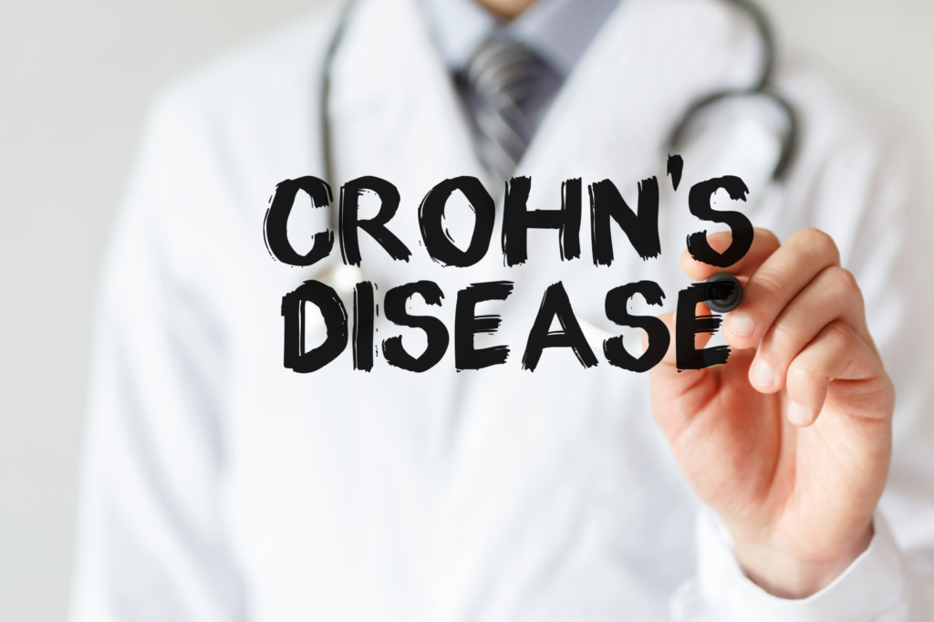 Maladie de Crohn, un régime peut conduire à une rémission