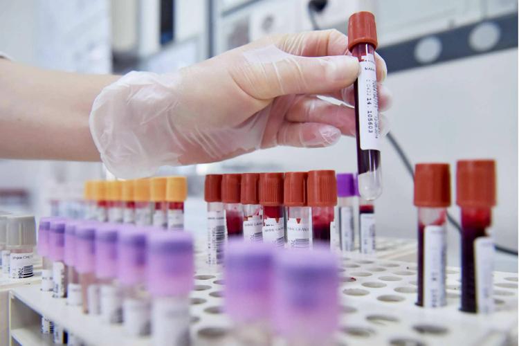 Leucémie lymphoïde chronique, nouveau traitement à durée fixe disponible en Italie