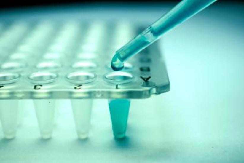 Pharmaceutique, Ipsen entre dans le monde des maladies hépatiques rares