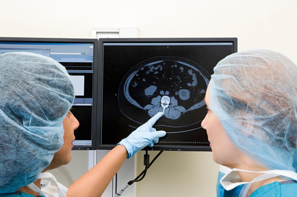 Kinsella et cancer du cerveau, quel est le glioblastome qui l'a touchée