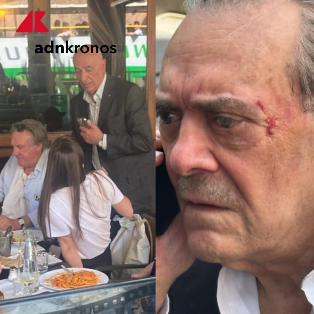 Barillari battu par Depardieu via Veneto finit à l'hôpital.  Le photojournaliste : "Je le rapporte" - Les photos exclusives
