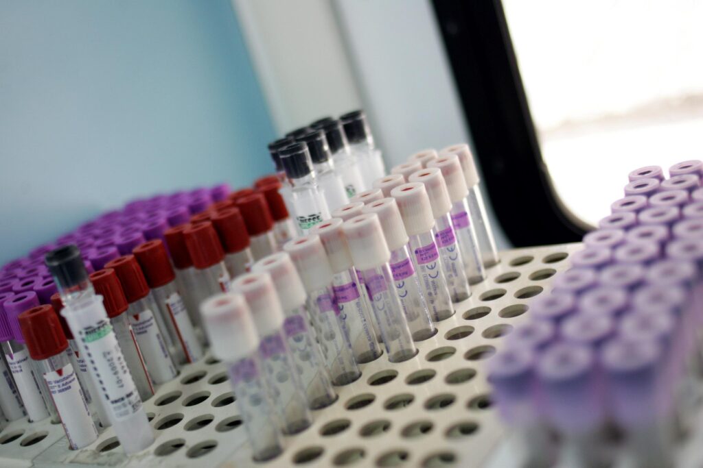 Recherche : l'albumine des protéines sanguines prédit le risque de cancer et de crise cardiaque chez les « plus de 65 ans »