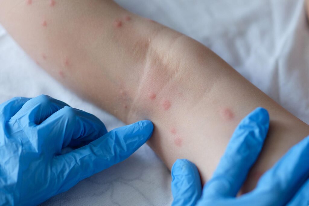 Dermatologues, groupe de travail immédiat pour former les médecins à l'IA