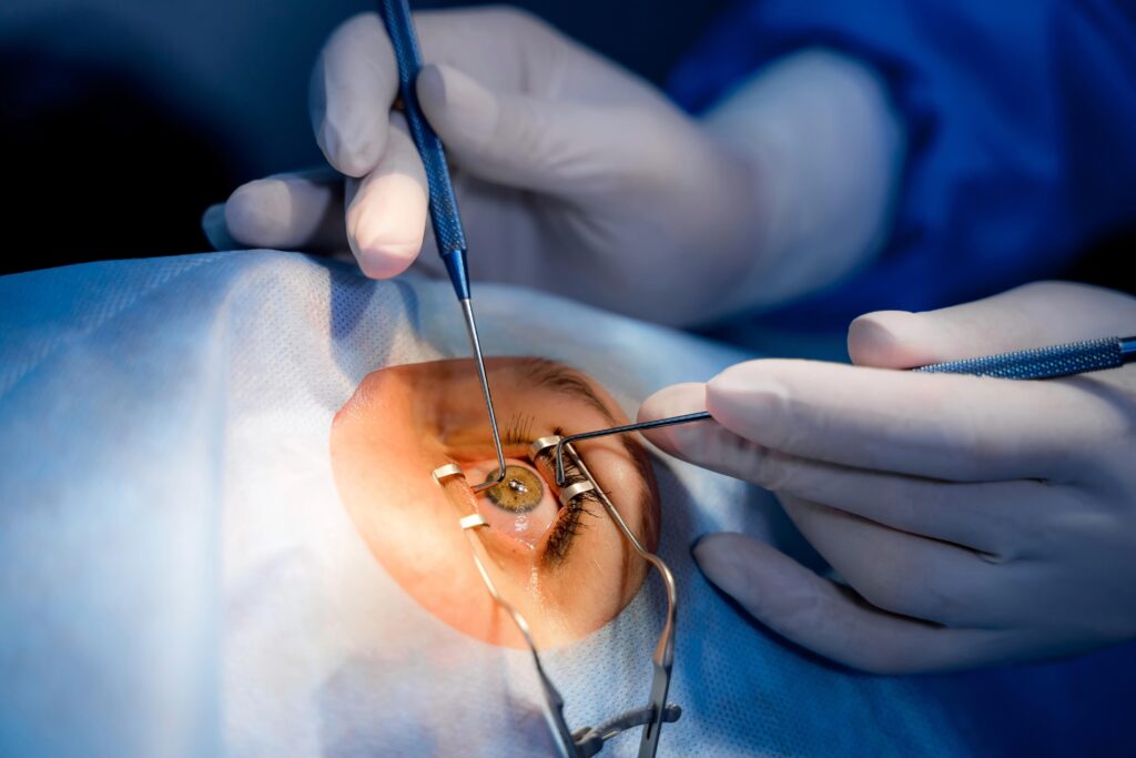 Médecine, 10 infections cornéennes par jour, une greffe partielle précoce sauve l'œil