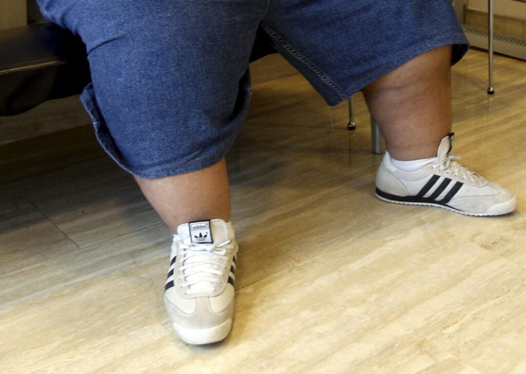 Nutritionniste, « sans politiques anti-obésité, moins d'années de vie pour les générations futures »