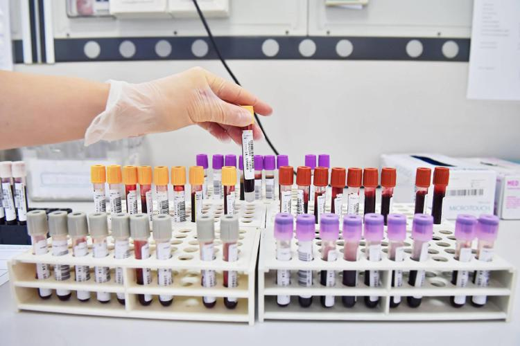 Uap : "Nous manifesterons contre les tests en pharmacie, le ministre Schillaci nous convoque"