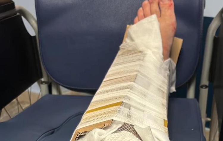 Fracture attelle avec du carton, responsable des urgences retiré