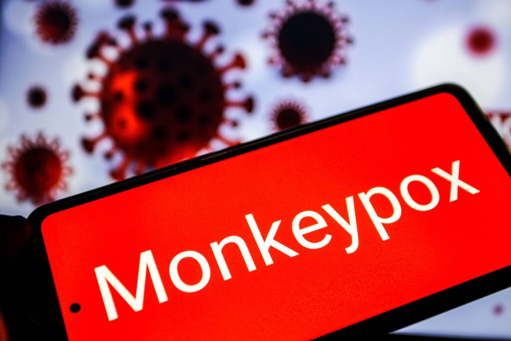 Monkeypox, aucun cas de nouvelle variante en Italie : la circulaire