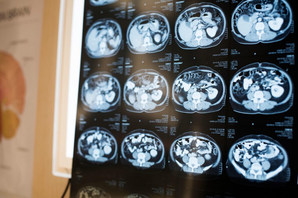 Après une blessure, une partie du cerveau s'endort : "Vous pouvez le réveiller"