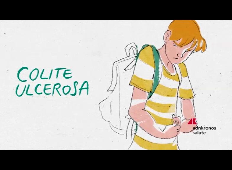 Lilly et l'AIFA approuvent le mirikizumab : premier médicament d'une nouvelle classe remboursé pour le traitement de la colite ulcéreuse