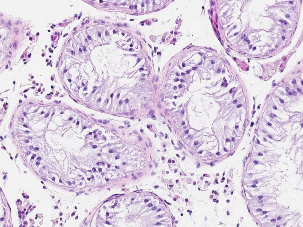 Nobel de médecine, le prix des microARN : surligneurs dans le manuel d'instructions des cellules