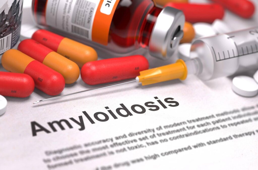 Amylose de la transitise et de la cardiomyopathie, OK à la nouvelle thérapie