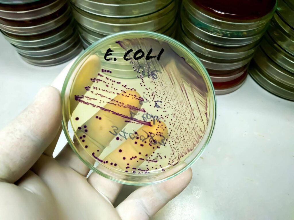 De Salmonella à Listeria en passant par E.Coli, hypothèses sur le terrain dans les toxications alimentaires