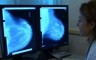 Les femmes ont opéré pour un cancer du sein, 70% des soins et 30% de la peur pour le travail