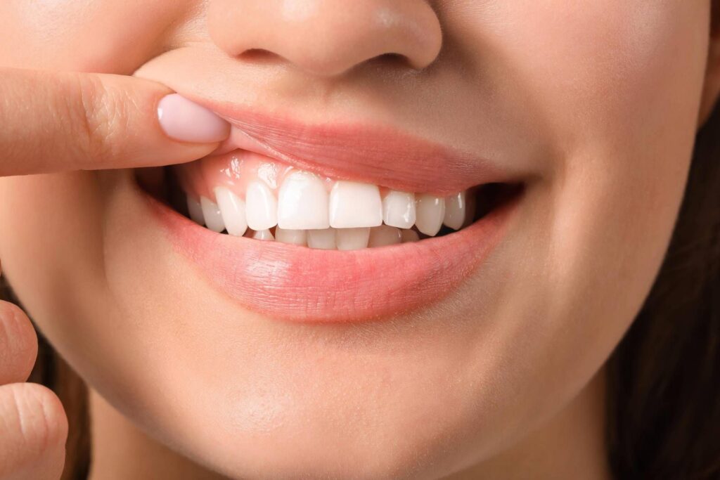 Santé chez 70% de personnes ayant des problèmes d'autisme avec les dents et les gencives, parodontologues sur le terrain