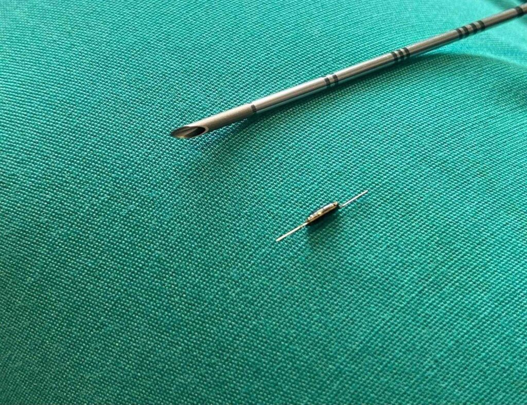 Des États-Unis en Italie, au San Camillo dans le dispositif de haute technologie de Rome pour la chirurgie de précision oncologique