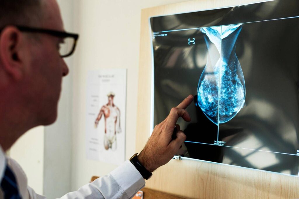 FOCE: "Approchez la mise à jour LEA pour garantir des tests moléculaires pour 87 000 patients oncologiques chaque année"