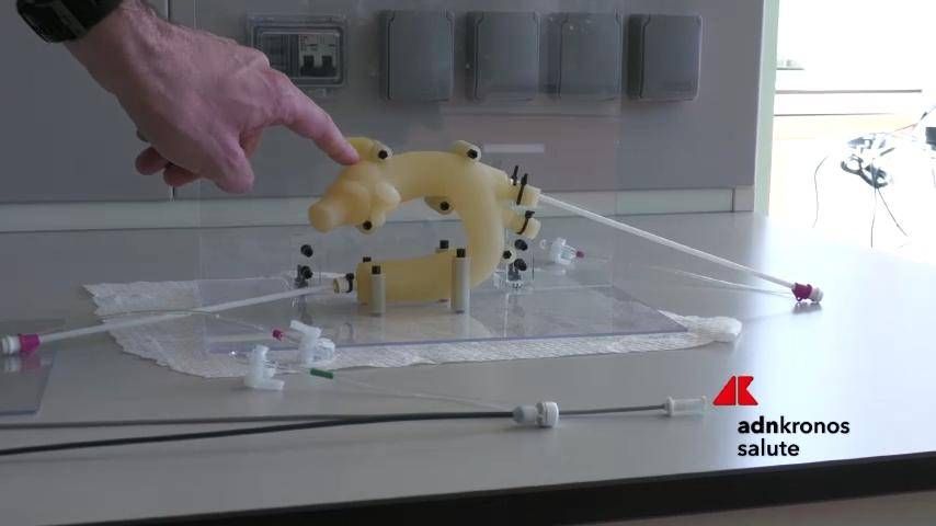 Santé, Lorenzo Menicanti (IRCCS Policlinico San Donato): "Hôpital du cœur parmi les premiers en Europe"