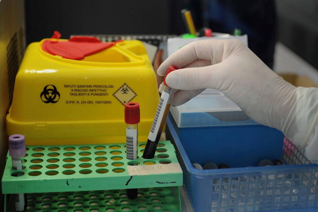 Alzheimer, allez -a tête pour un test sanguin pour le diagnostic: ce que cela signifie