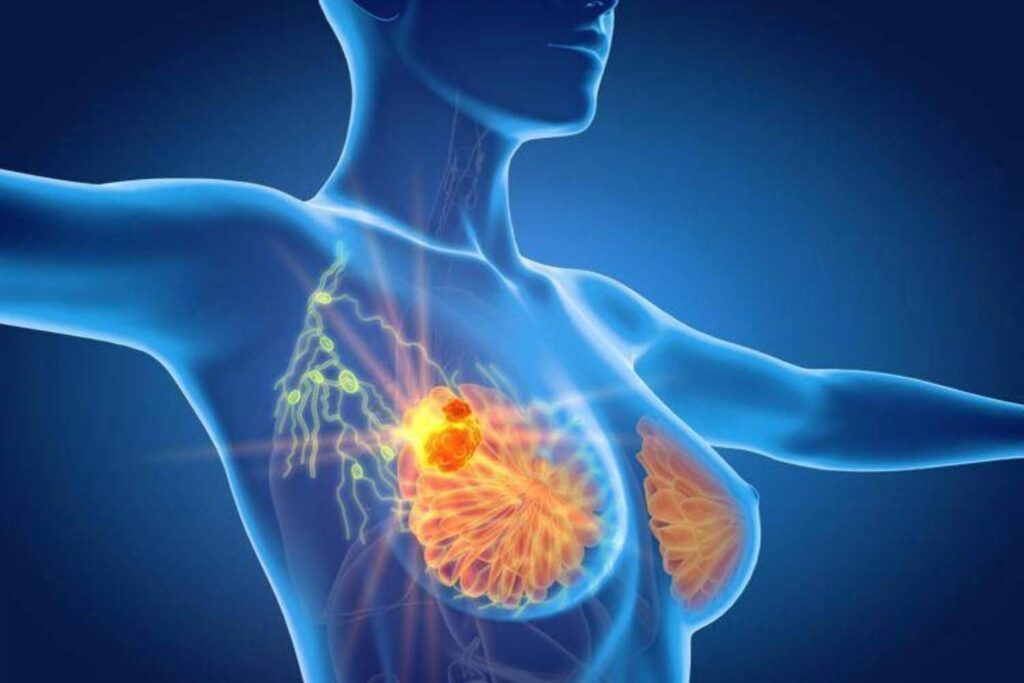 Cancer négatif du sein triple, espoir de l'anticorps centré sur le médicament