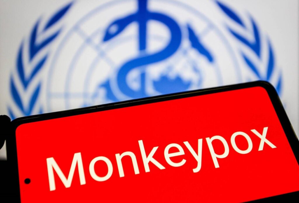 MPOX, donc la variole des singes doit être gérée à la maison ou à l'hôpital