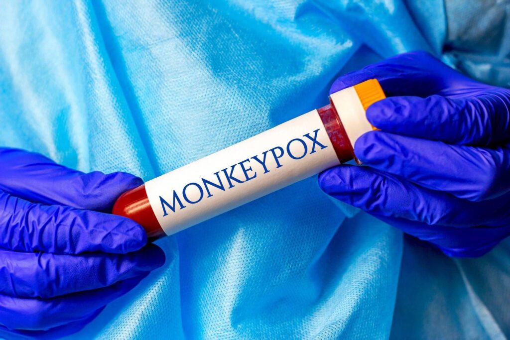 Scumie Smallpox, cas à Terni: une source de contagion inconnue, surveillée 2 chats de la maison