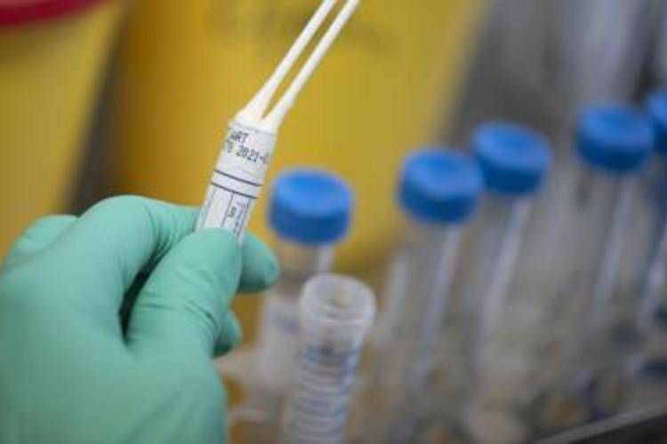 Legionella dans des logements sociaux à Milan, un mort et plusieurs hospitalisés