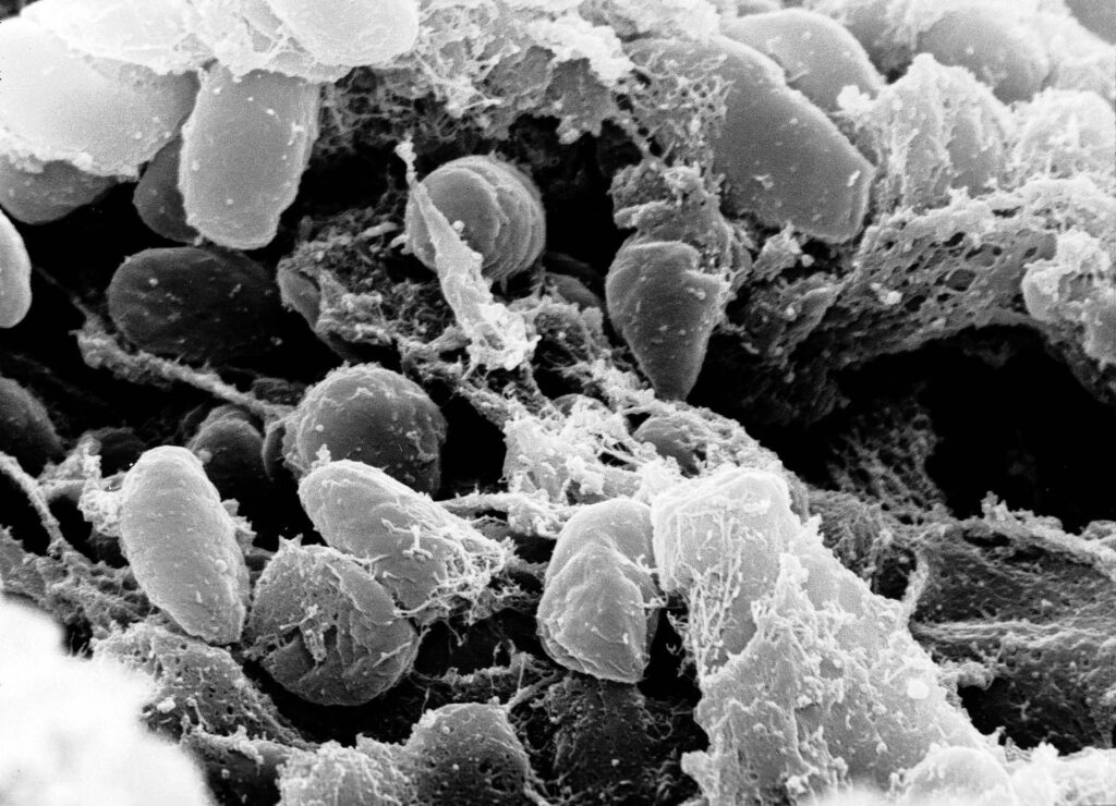 Recherche, Scorrano (Tor Vergata): "De l'ADN de 1 313 ancêtres l'évolution des maladies infectieuses"