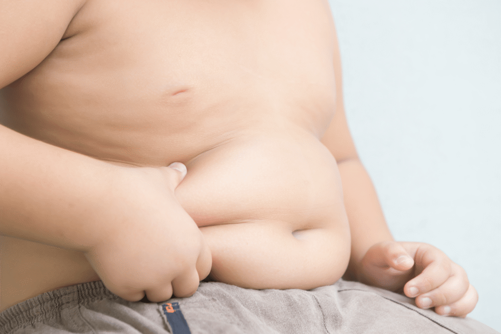 Santé, test génétique prédit l'obésité chez les enfants de moins de 5 ans: International Maxi-studio
