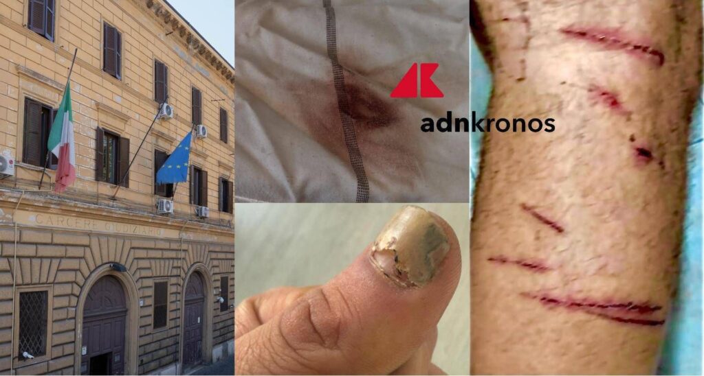 "Beat et saisi deux jours par d'autres prisonniers à Regina Coeli", le rapport de choc