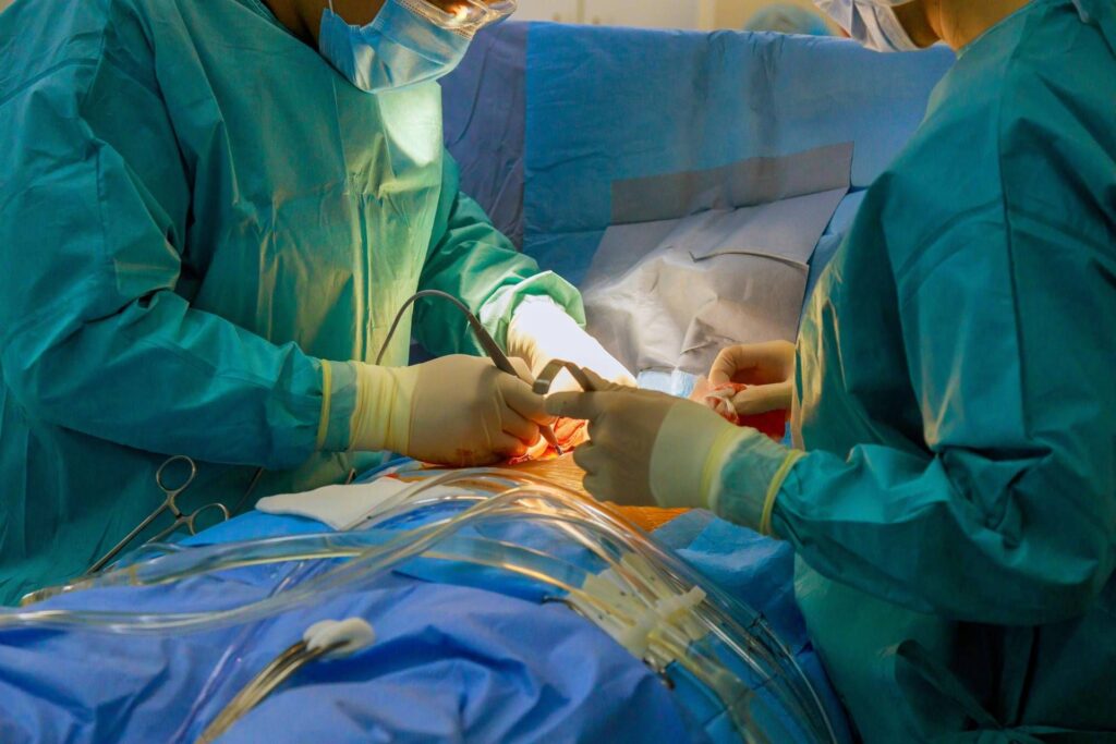 Chirurgie, à Padoue Intervention innovante pour les soins médicament résistant à l'épilepsie