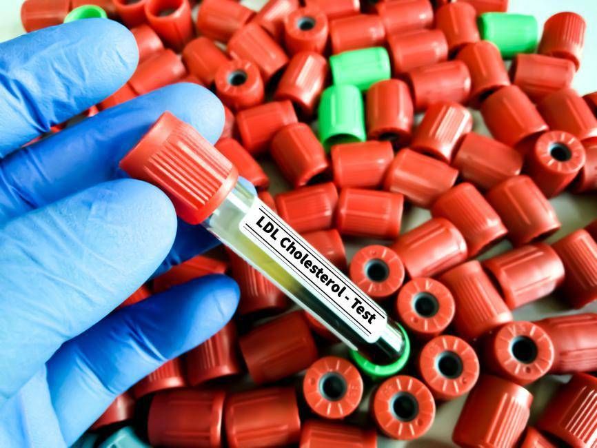 Cholestérol LDL, pour le réduire dans le développement d'une nouvelle thérapie avec une triple combinaison