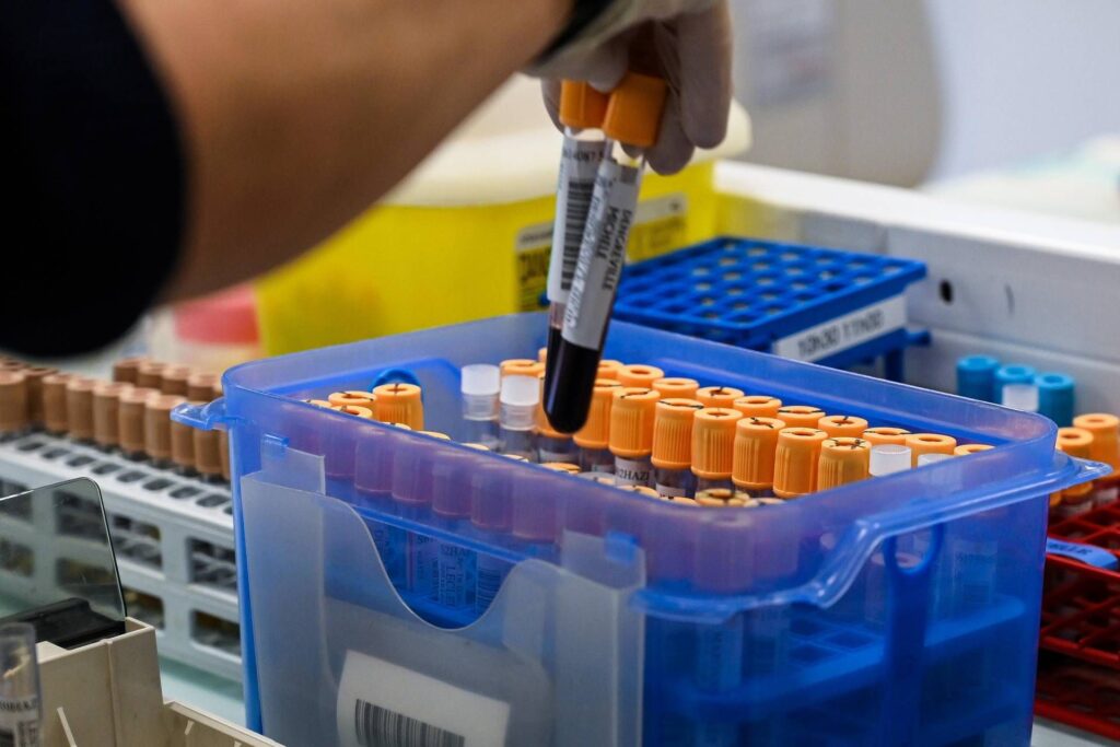 Liver, un test pour découvrir le risque de maladies graves dans les 10 ans: l'étude