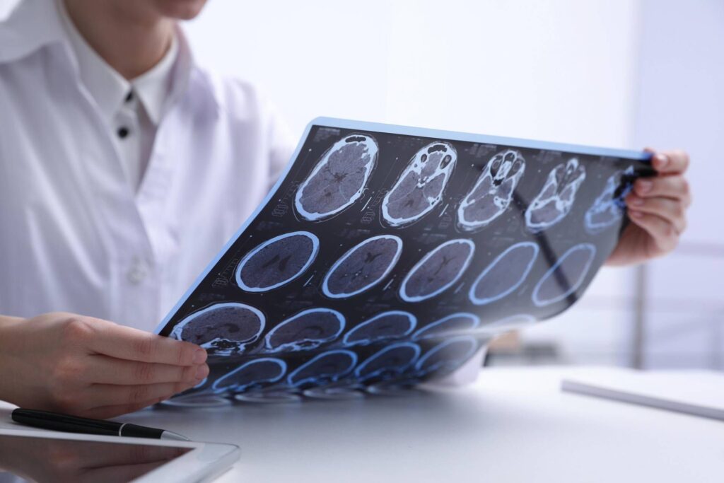 SLA Day, Neurologies: "Vous ne vous limitez pas à l'expérimentation"