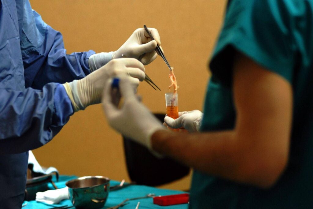 Transplant, à Modène le premier en Europe du foie de Donor vivant avec robot