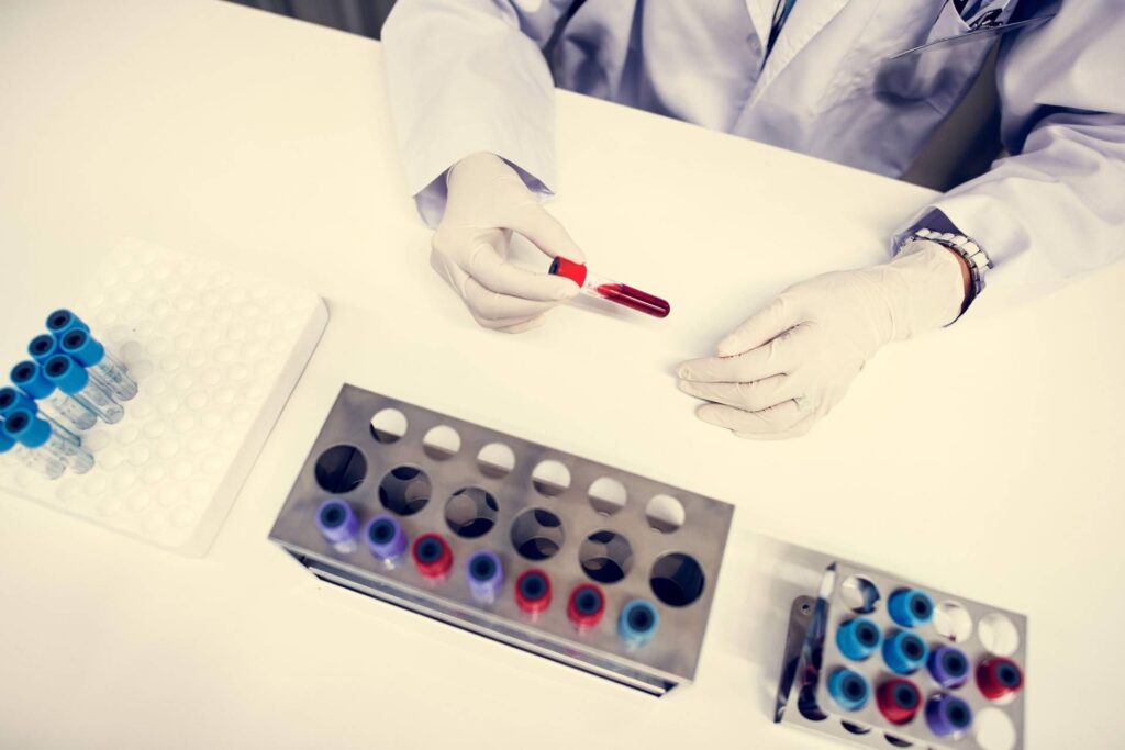 Cancer de la vessie, récidive réduite de 32% avec l'immunothérapie par durvalumab : l'étude