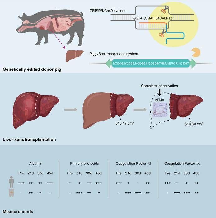 En Chine, la première greffe de foie porc-humain au monde a fonctionné pendant un mois
