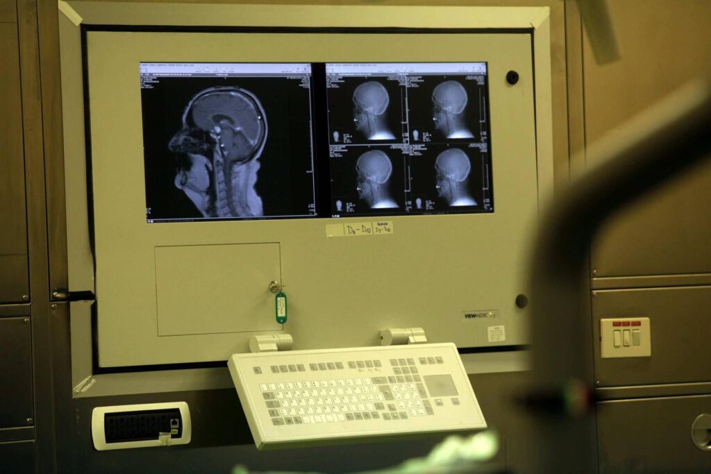 Médecine : Sin Congress, la neurologie entre innovation, responsabilité et nouvelle organisation