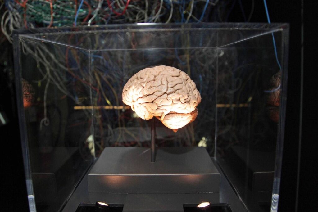 Médecine, neurologues : "L'innovation peut changer l'histoire de nombreuses maladies mais l'équité est nécessaire"