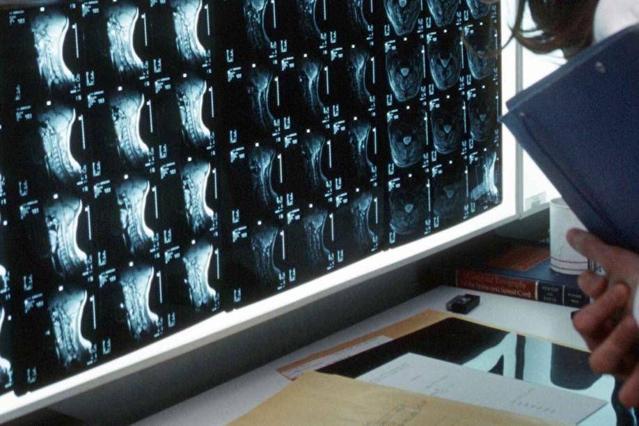 Plus de 500 maladies osseuses rares, experts : « Investir dans la prévention et le diagnostic »