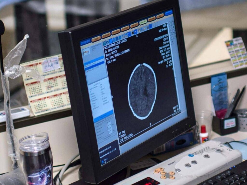 Santé, Padovani (Sin) : « La longévité augmente le risque d'Alzheimer, agissez en matière de prévention »