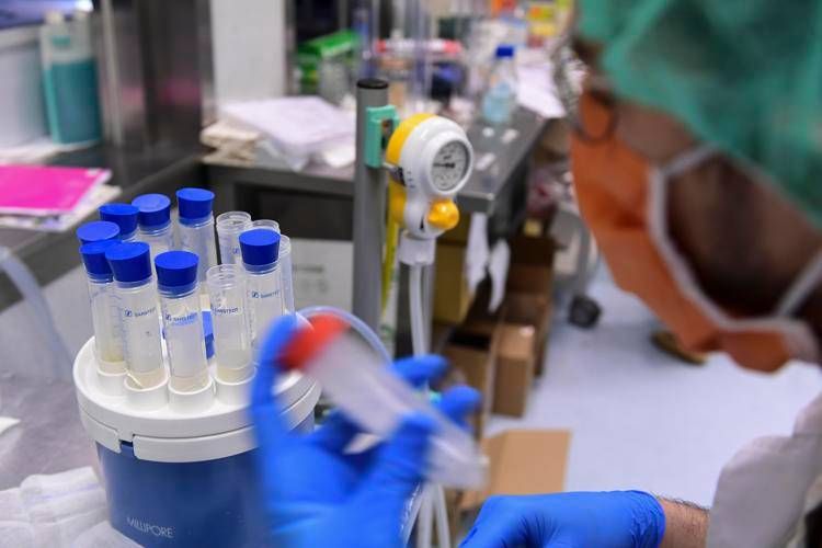 Legionella, la bactérie qui adore les canalisations et les climatiseurs : les cas en hausse en Italie