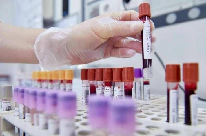 Alerte des oncologues : "- 50% d'essais en Europe en 10 ans alors que la Chine accélère"