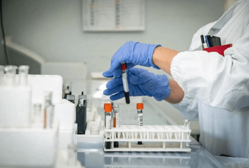 Alzheimer, un nouveau test sanguin pour un diagnostic précoce à l'étude