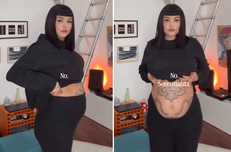 Endométriose, l'éclat de Giorgia Soleri et l'avis de l'expert : "Avec les nouvelles thérapies, la fertilité s'améliore"