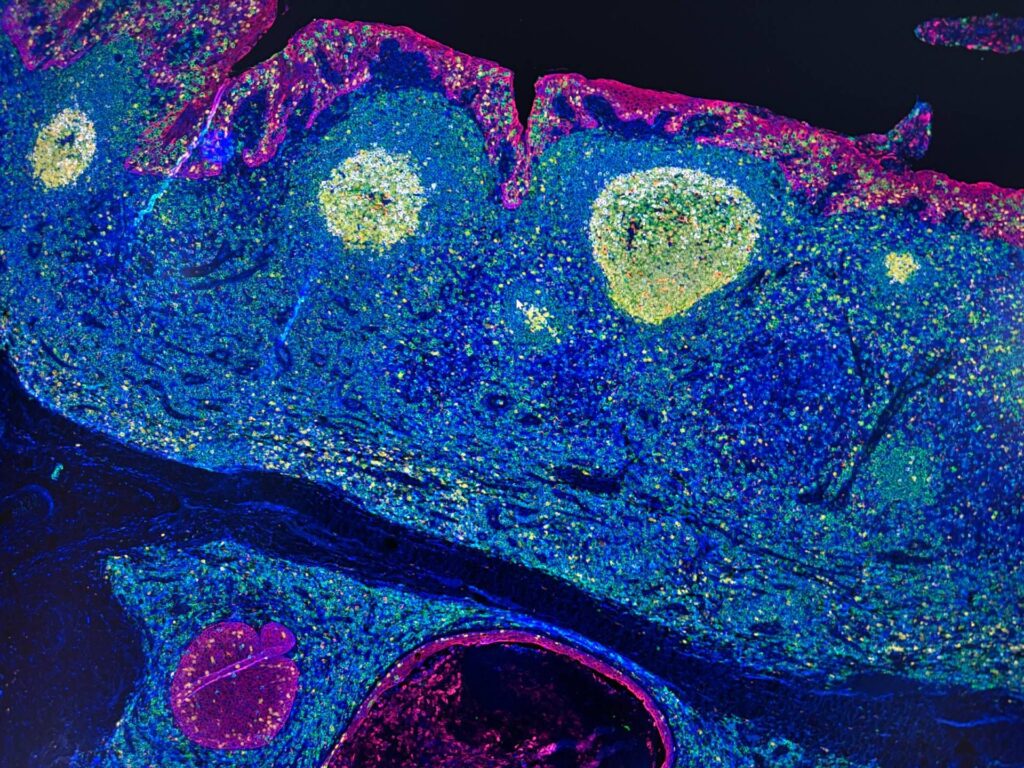 Irccs Pascale Napoli, la « carte GPS » des cellules révolutionne l'immunothérapie