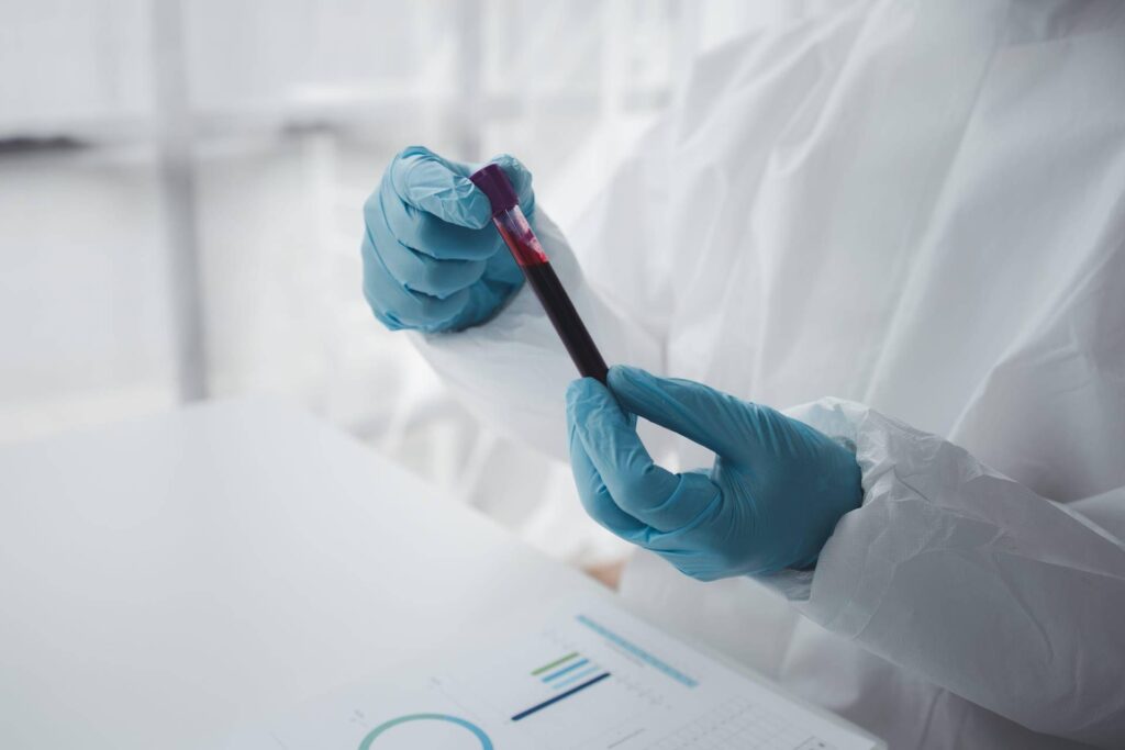 L'hépatite A est en forte croissance en Italie : le Latium, la Campanie et les Pouilles sont les régions avec le plus de cas