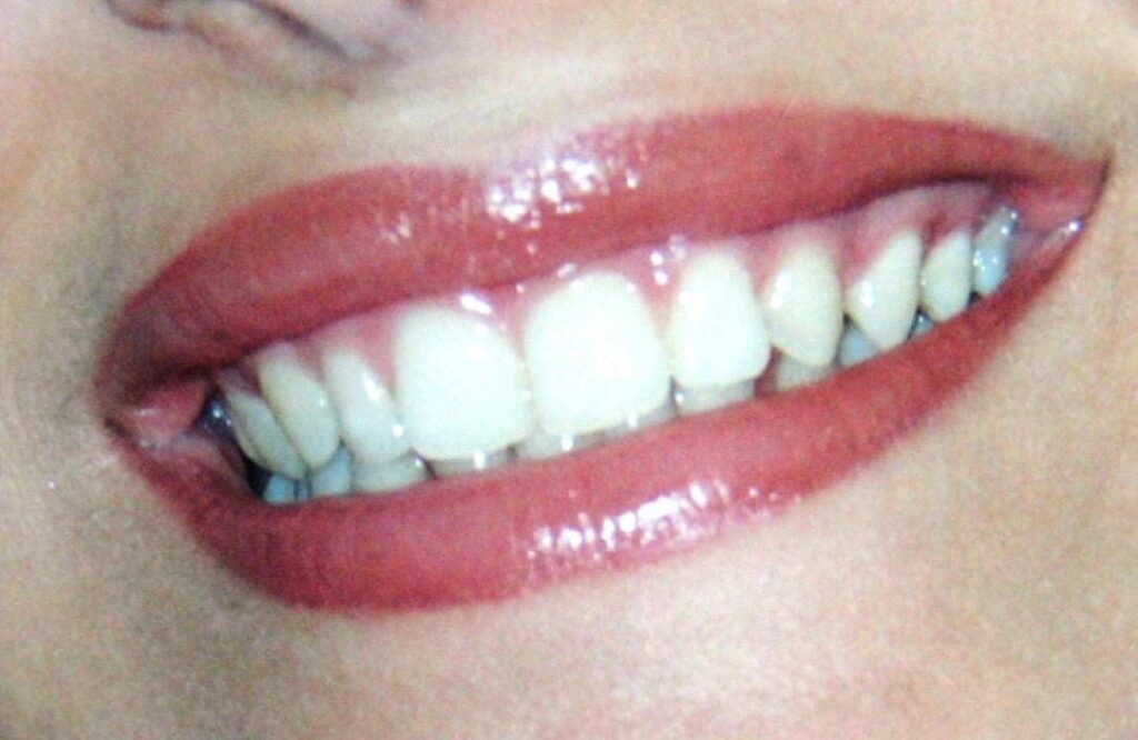 Dentiste sans réservation à Rome, sur l'île Tibérine, visites immédiates pour urgences et contrôles